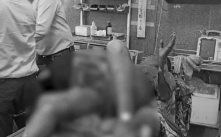 Bikaner News: SP ऑफिस के सामने खुद को आग लगाने वाले पूर्व वार्ड पंच रामलाल की जयपुर में मौत