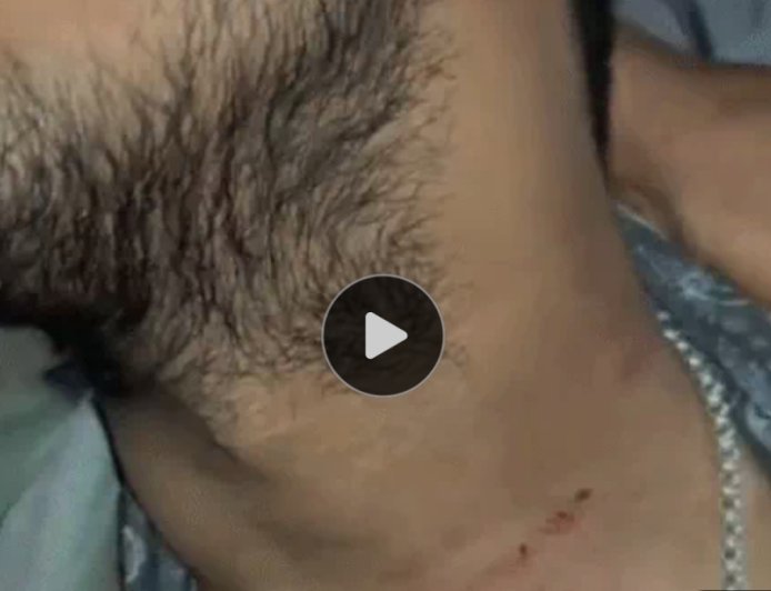 Bikaner News: सैंडविच को लेकर कैफे संचालक और पुलिस में विवाद, मारपीट के आरोप के बाद थाने के बाहर जुटी भीड़