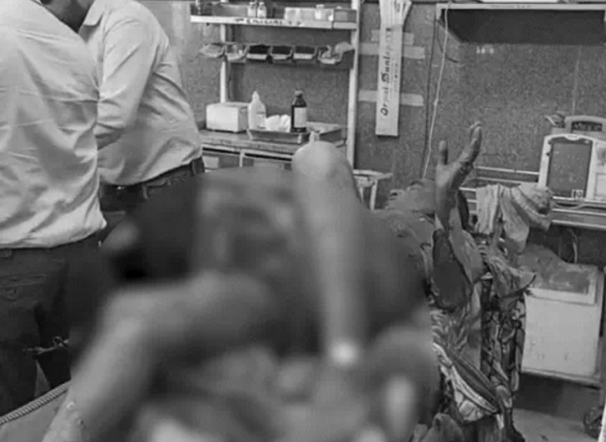 Bikaner News: SP ऑफिस के सामने खुद को आग लगाने वाले पूर्व वार्ड पंच रामलाल की जयपुर में मौत